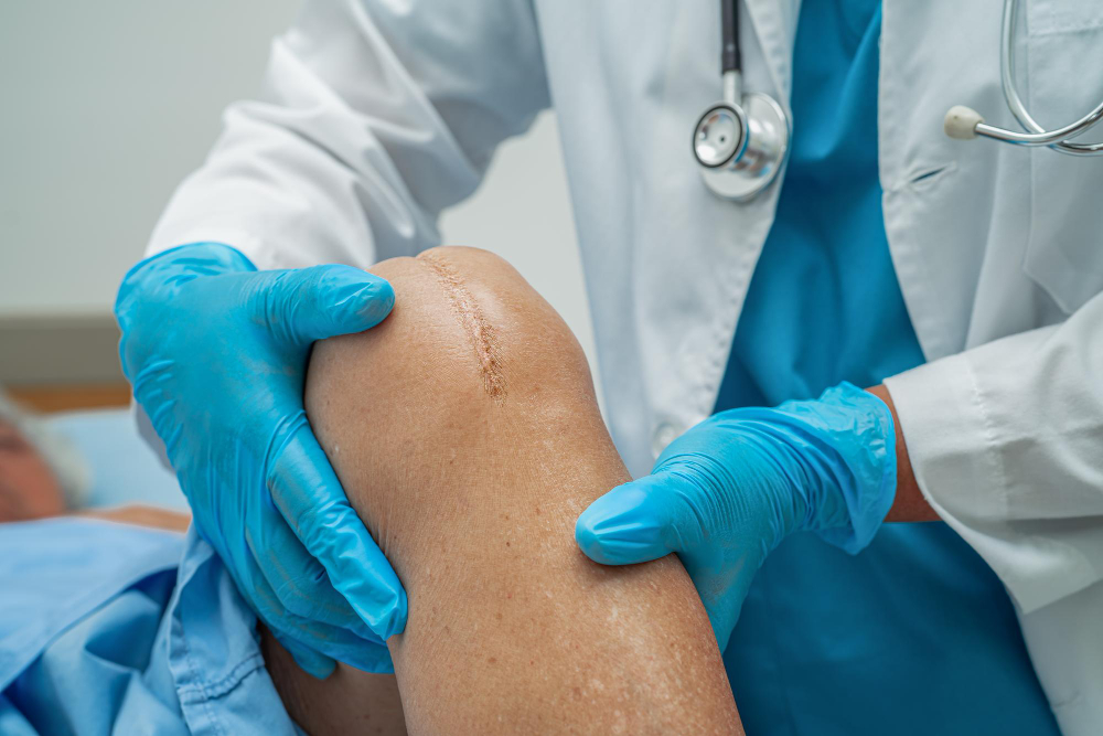 Knee replacement