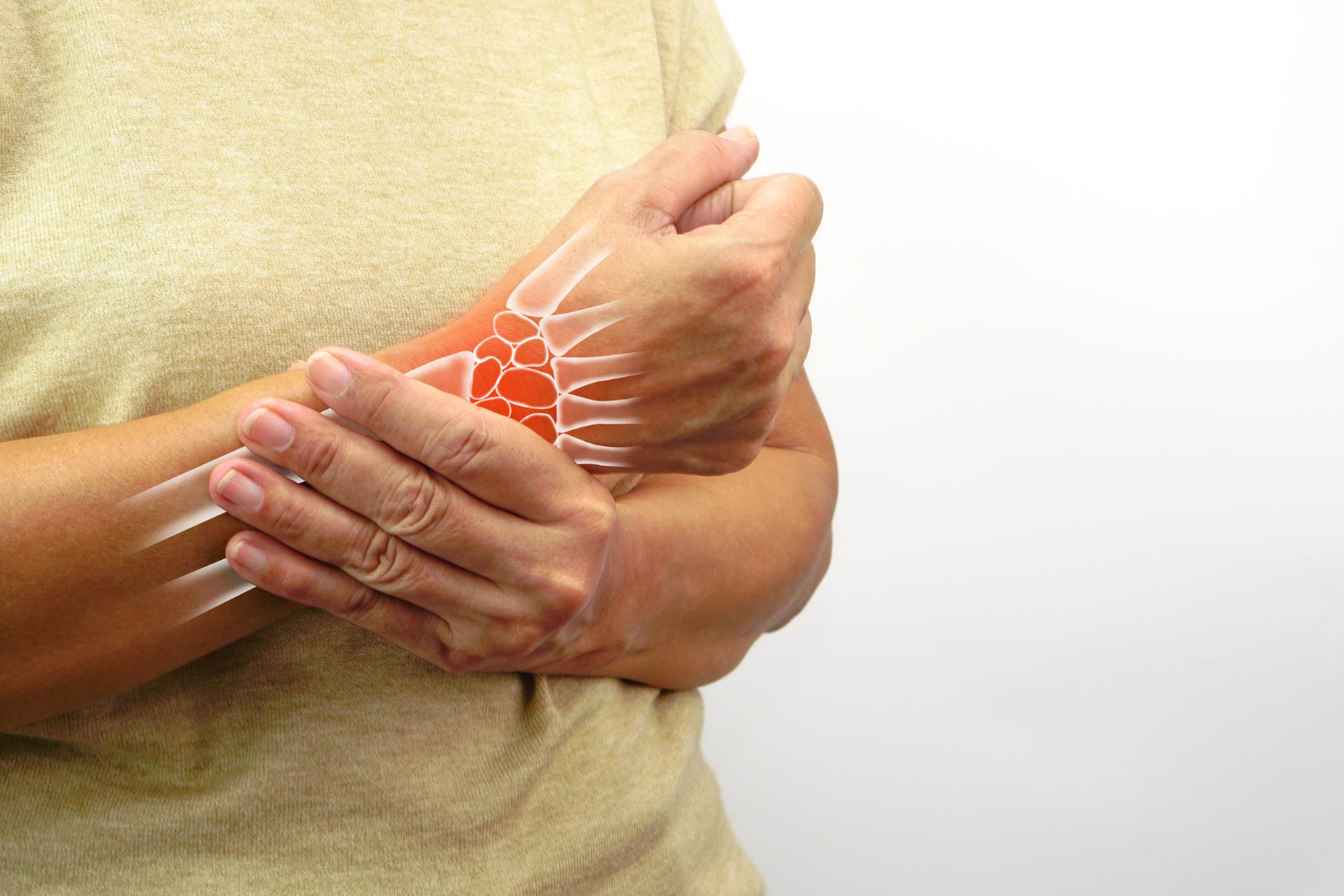 Arthritis
